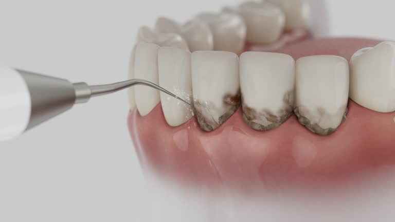 Trusted Dental Crowns And Bridges service in Inglis, FL - Dentist Open Now